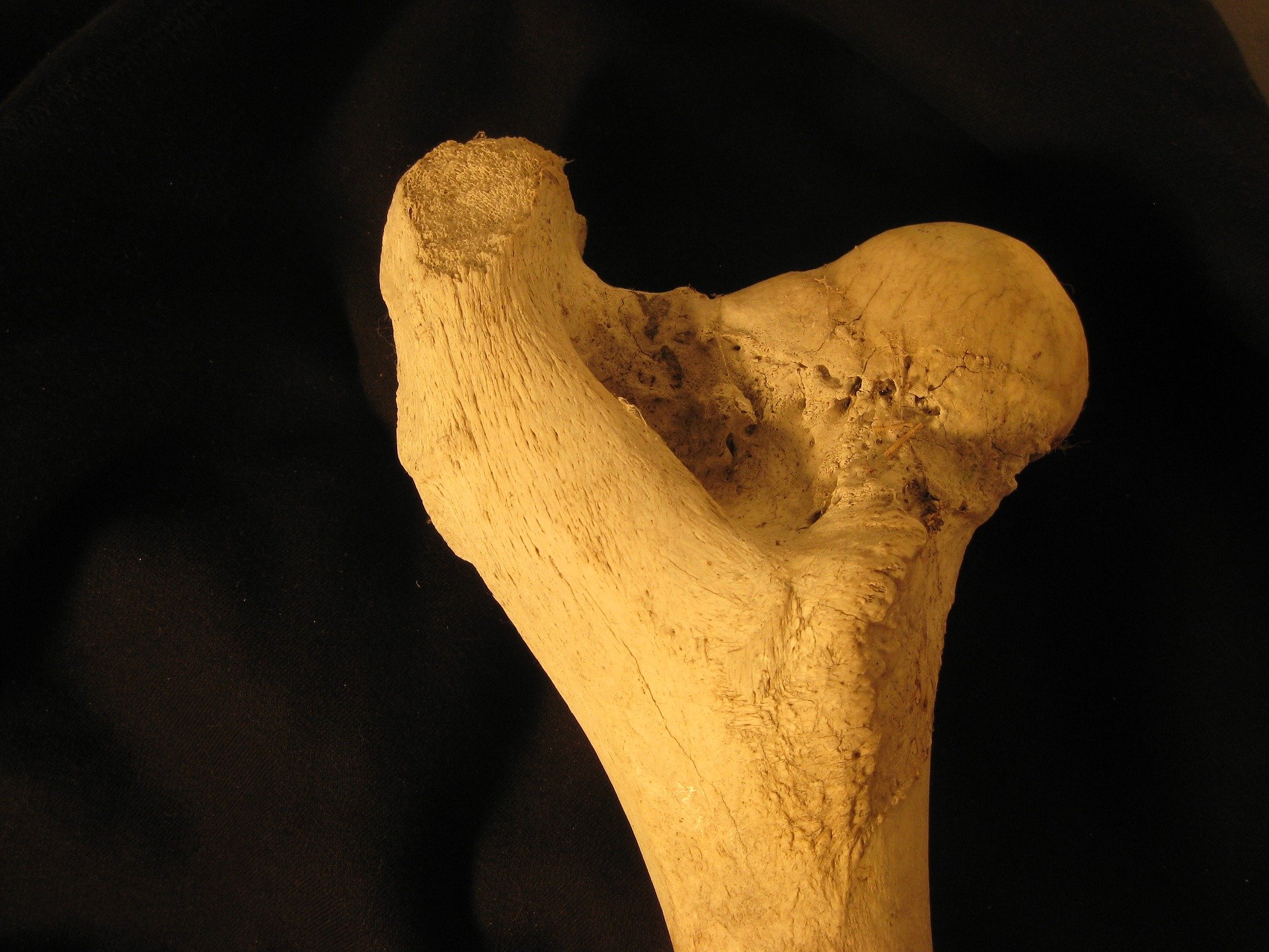 bone-1913914_1920